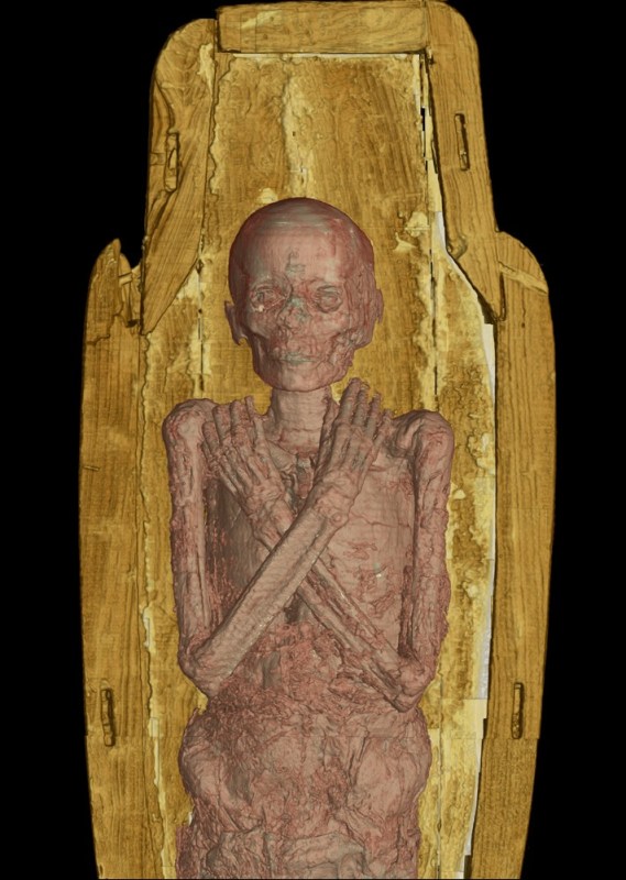 Mummy Exhibit