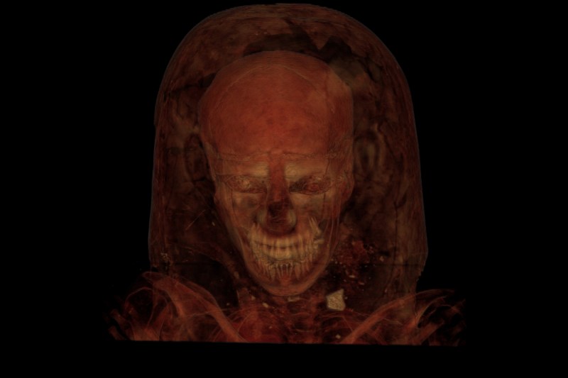 A CT scan of a mummy The Field Museum)