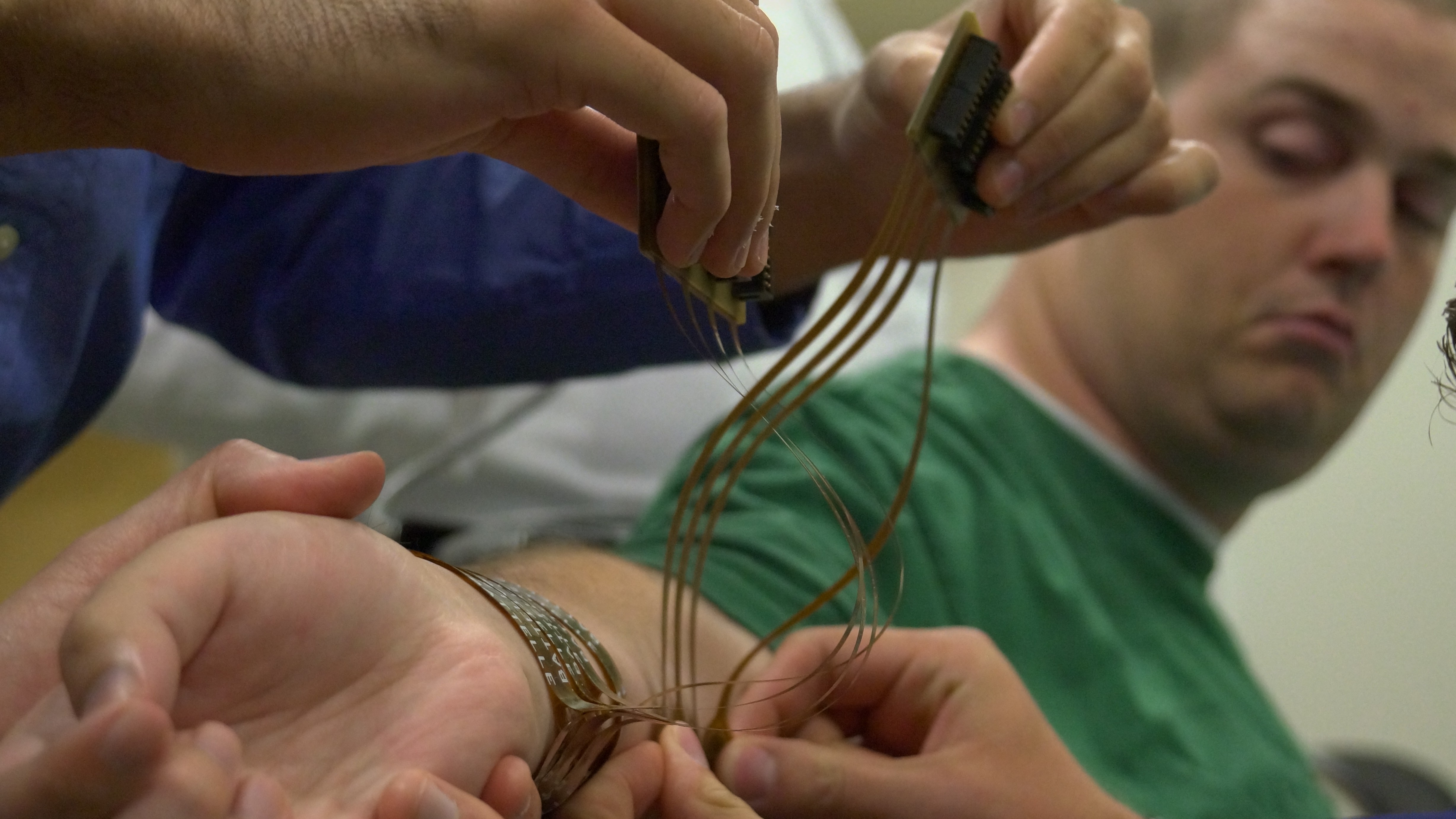 **Embargo until 12:01 AM 6/24/14** COLUMBUS, OH - JUNE 18: Ian Burkhart watches as researchers connect a sleeve of electrodes to his arm during a training session in Columbus, OH on June 18, 2014. They will relay electronic signals from a computer connected to a chip implanted in the part Burkharts brain controlling motor movement of the hand. (Photo by Lee Powell / The Washington Post via Getty Images)