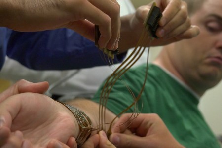 **Embargo until 12:01 AM 6/24/14** COLUMBUS, OH - JUNE 18: Ian Burkhart watches as researchers connect a sleeve of electrodes to his arm during a training session in Columbus, OH on June 18, 2014. They will relay electronic signals from a computer connected to a chip implanted in the part Burkharts brain controlling motor movement of the hand. (Photo by Lee Powell / The Washington Post via Getty Images)