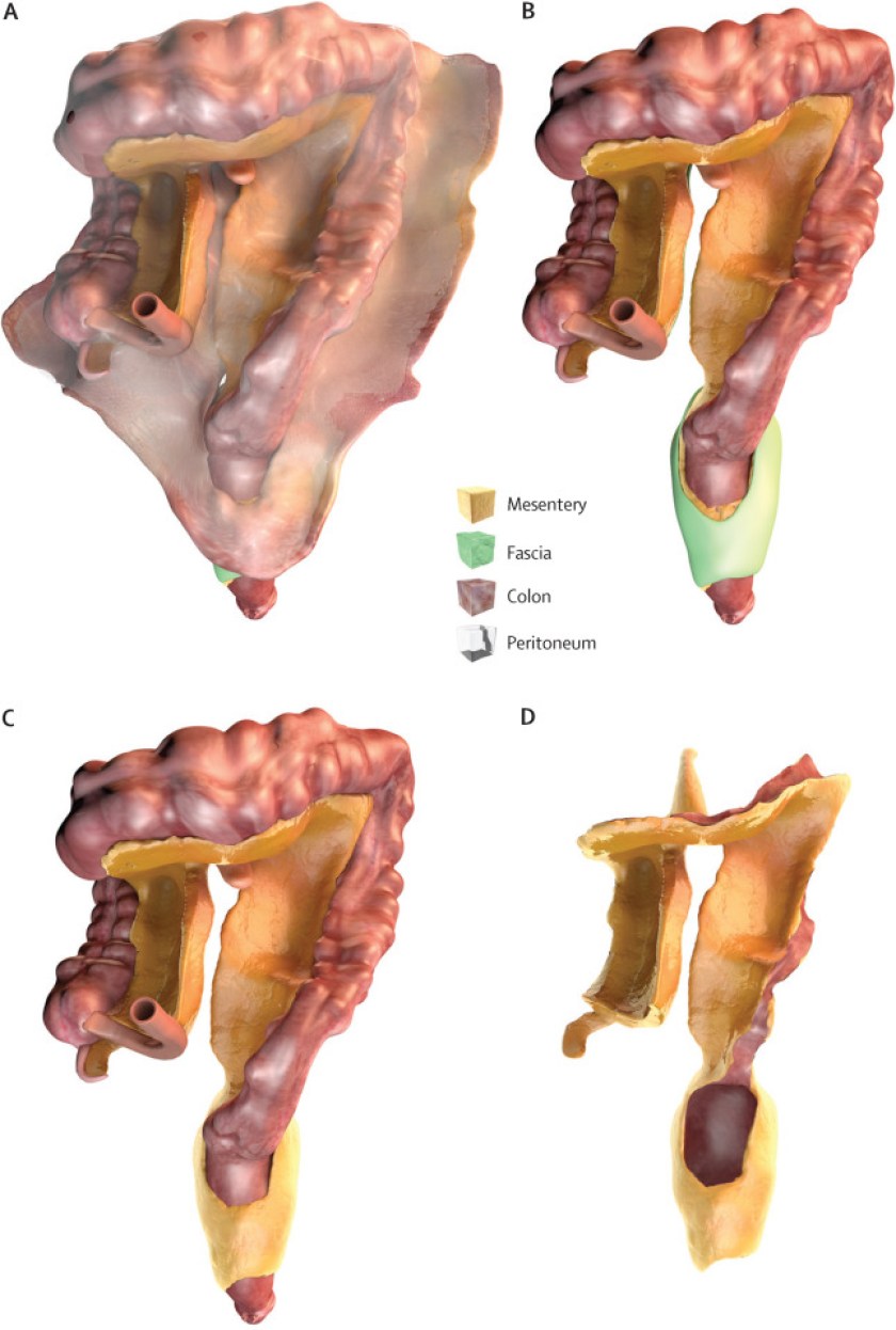 The New Bodily Organ the Mesentery