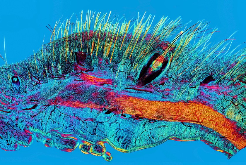 Wellcome image award winner David Linstead