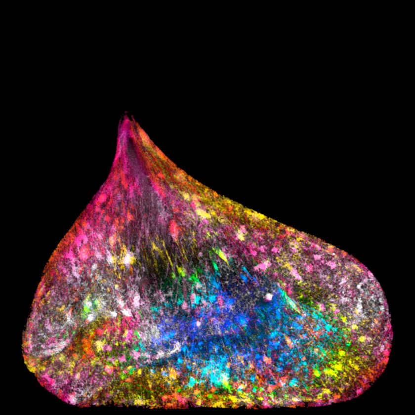 Unravelled DNA in a human lung cell (Ezequiel Miron, University of Oxford)