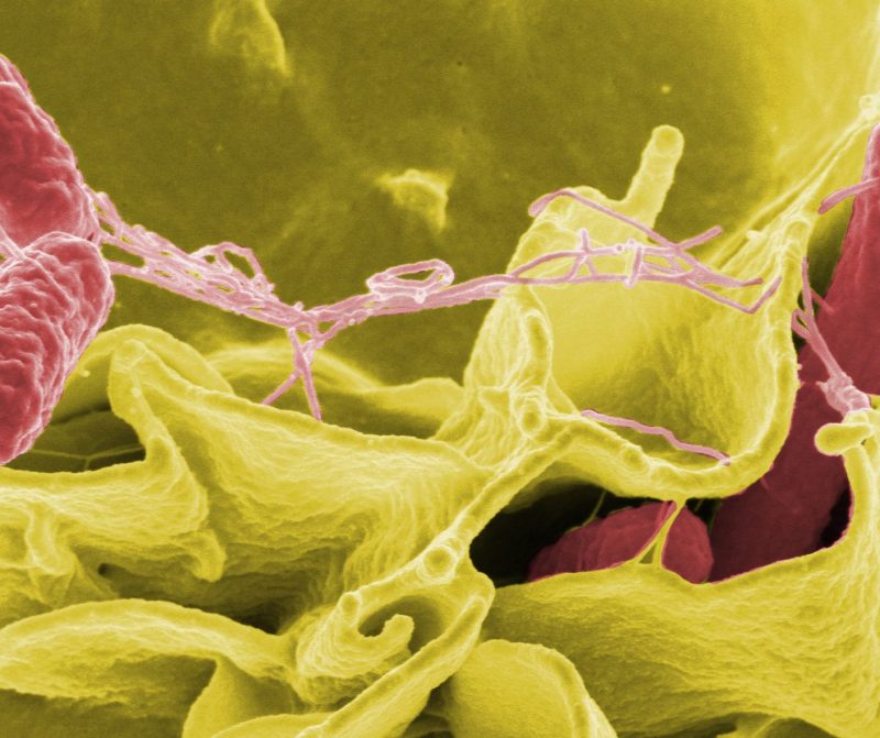 Color-enhanced scanning electron micrograph showing Salmonella typhimurium, in red, invading cultured human cells. (Rocky Mountain Laboratories/NIAID/NIH)