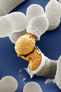 Microscopic image of east cells reproducing