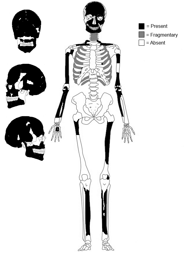 Is This the Oldest-Known Cancer Case in Central America?