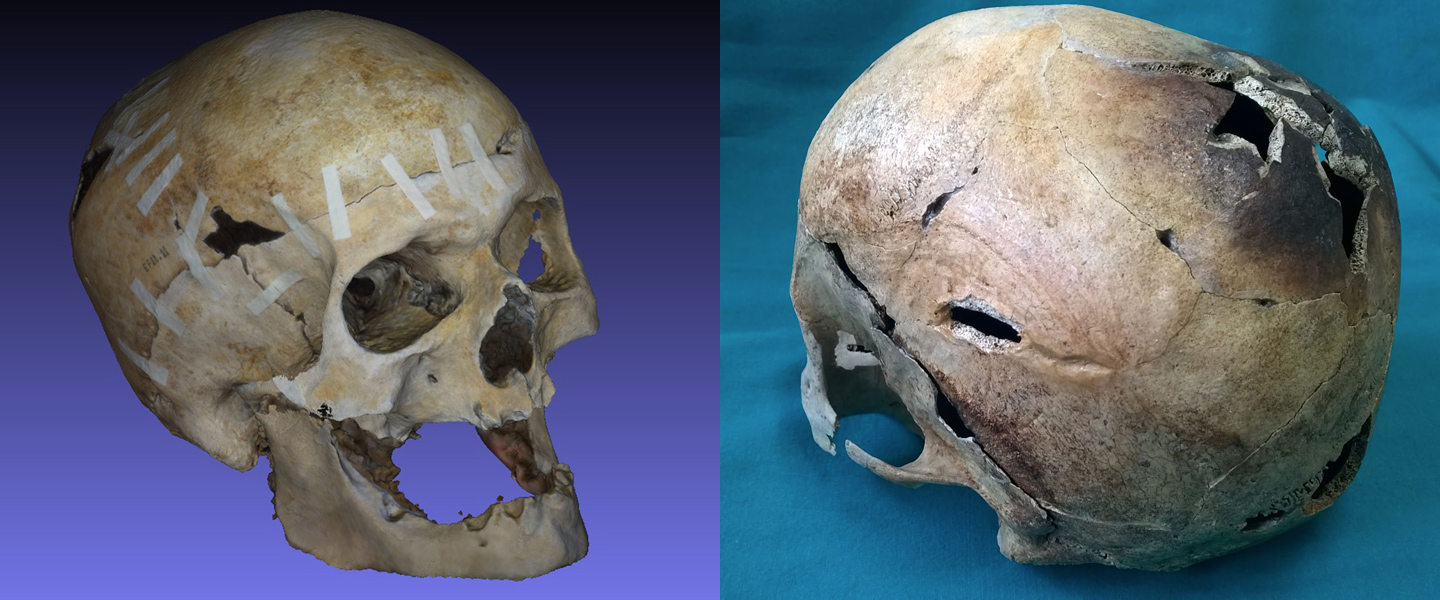 3d face Vesuvius victim