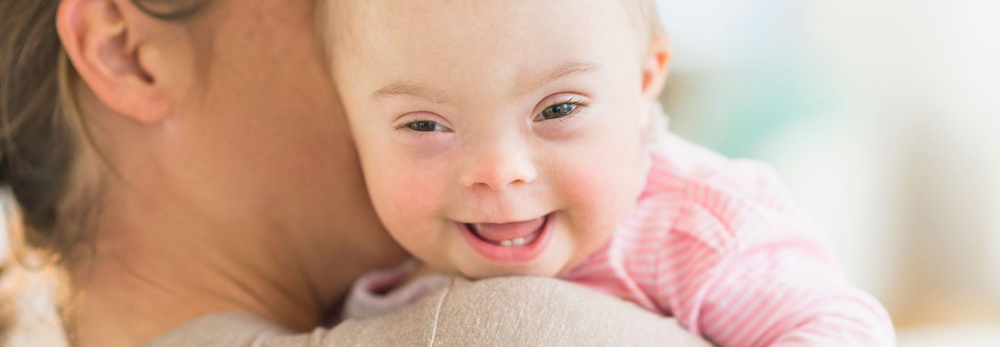 A baby girl with Down syndrome.