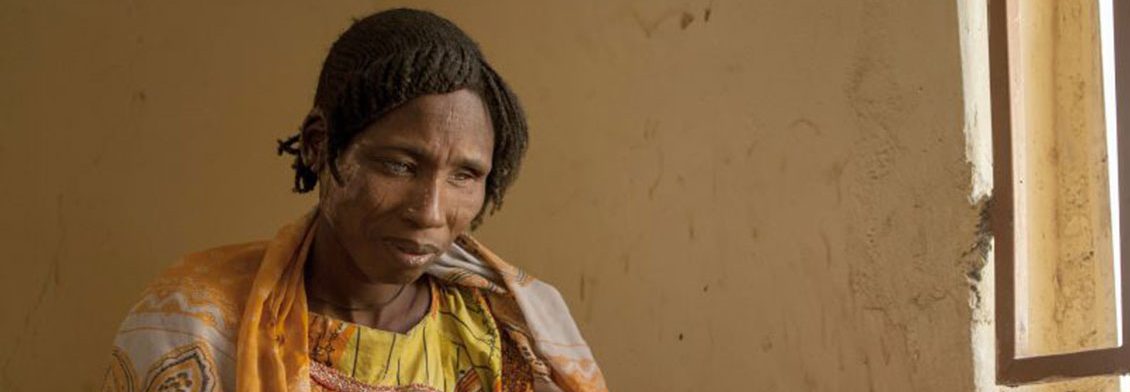 A woman receiving medical care for burns following clashes between the military and Boko Haram Islamists sits on a bed in Borno State, northeast Nigeria, on February 15, 2017. The Nigerian airforce has constructed a makeshift runway as part of military tactics to counter Boko Haram insurgency and to accelerate distribution of relief materials by donor agencies to internaly displaced people in north-eastern Nigeria, where the conflict with Boko Haram has killed at least 20,000 people and left more than 2.6 million homeless in its six-year insurgency. (AFP/FLORIAN PLAUCHEUR/Getty)