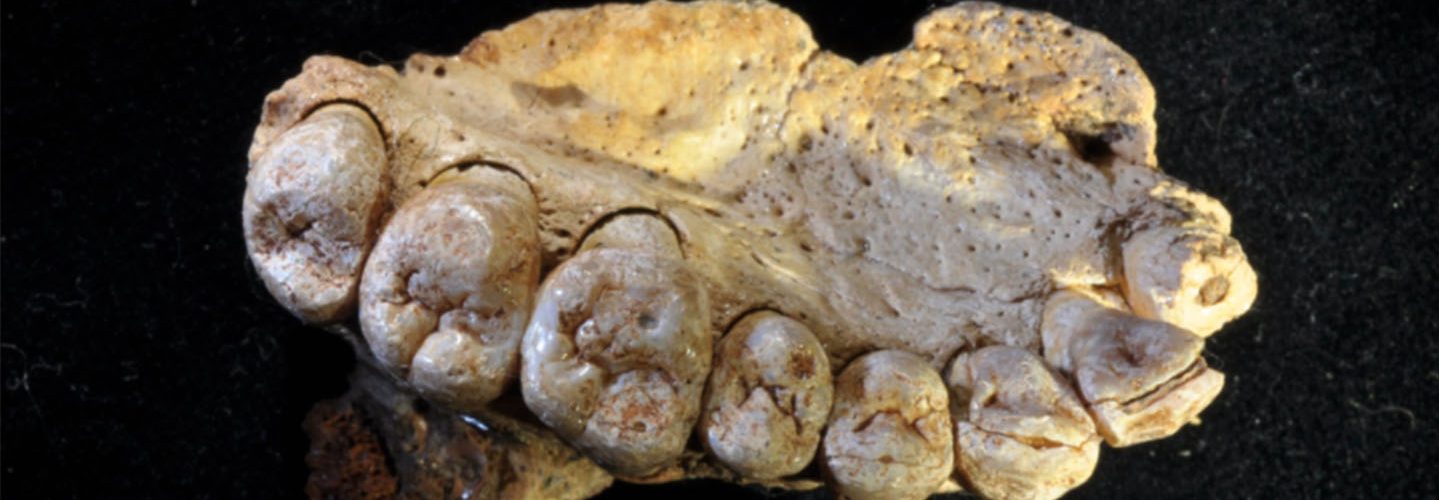 jawbone