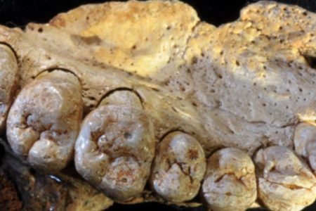 jawbone