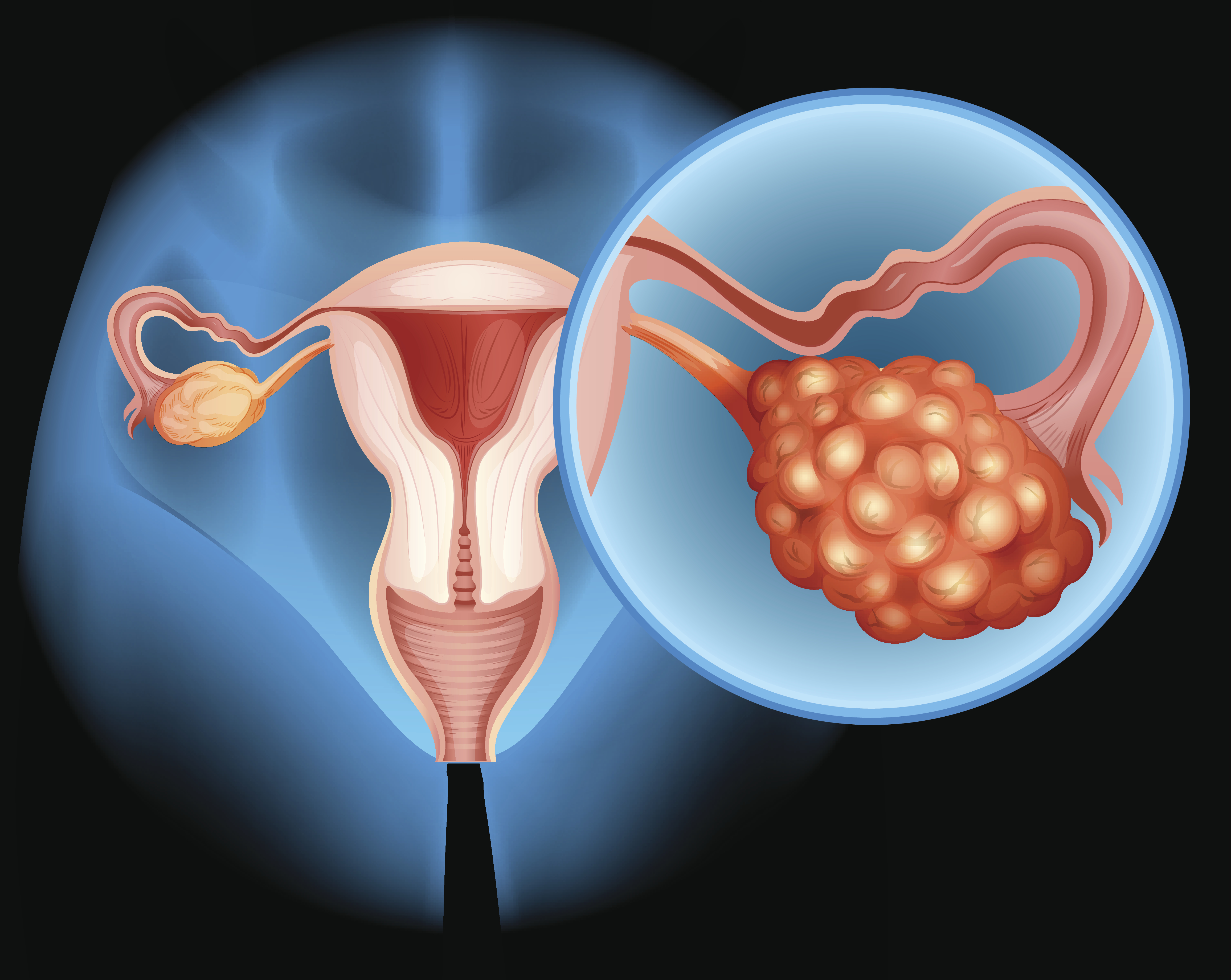 immunotherapy