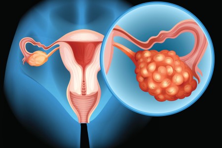 immunotherapy