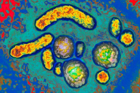 Hepatitis B