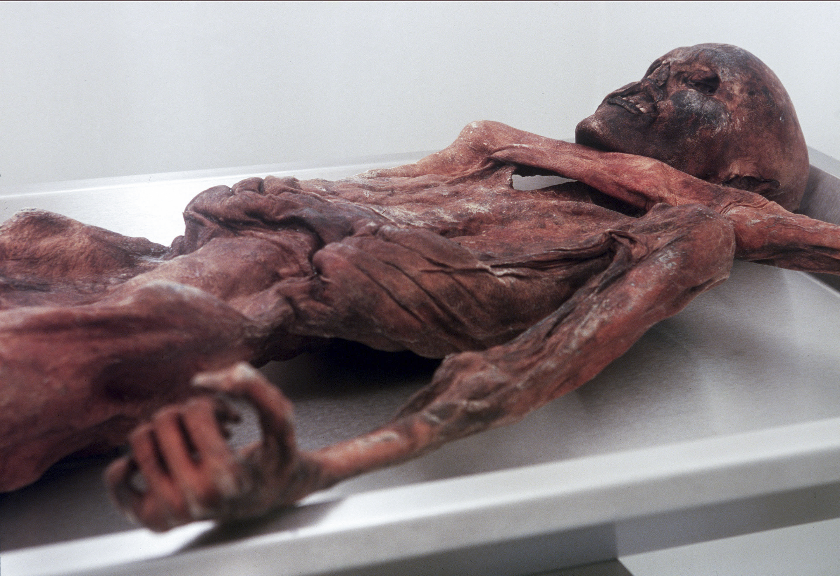otzi the iceman