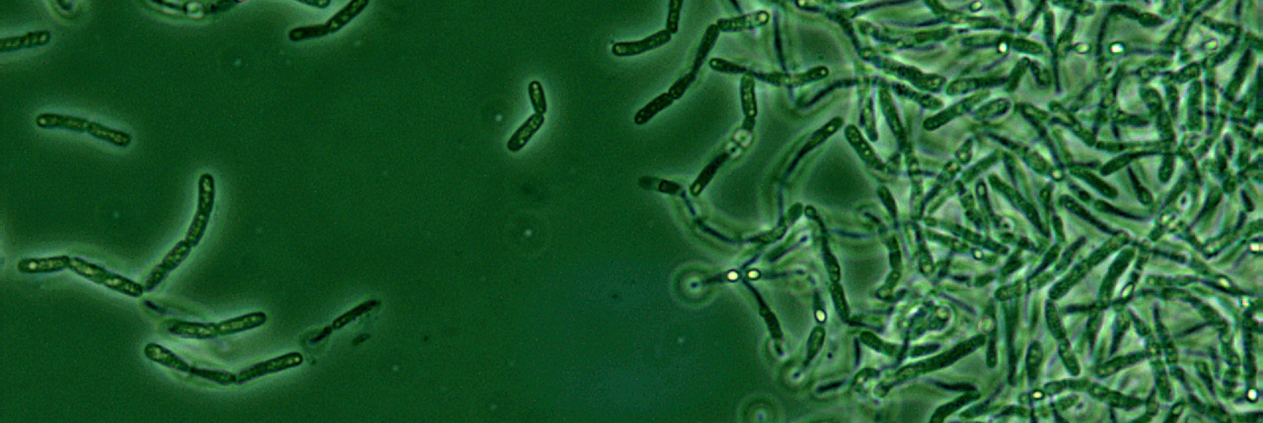 Bacillus anthracis spores seen under phase contrast microscopy. (Media for Medical/Getty Images)