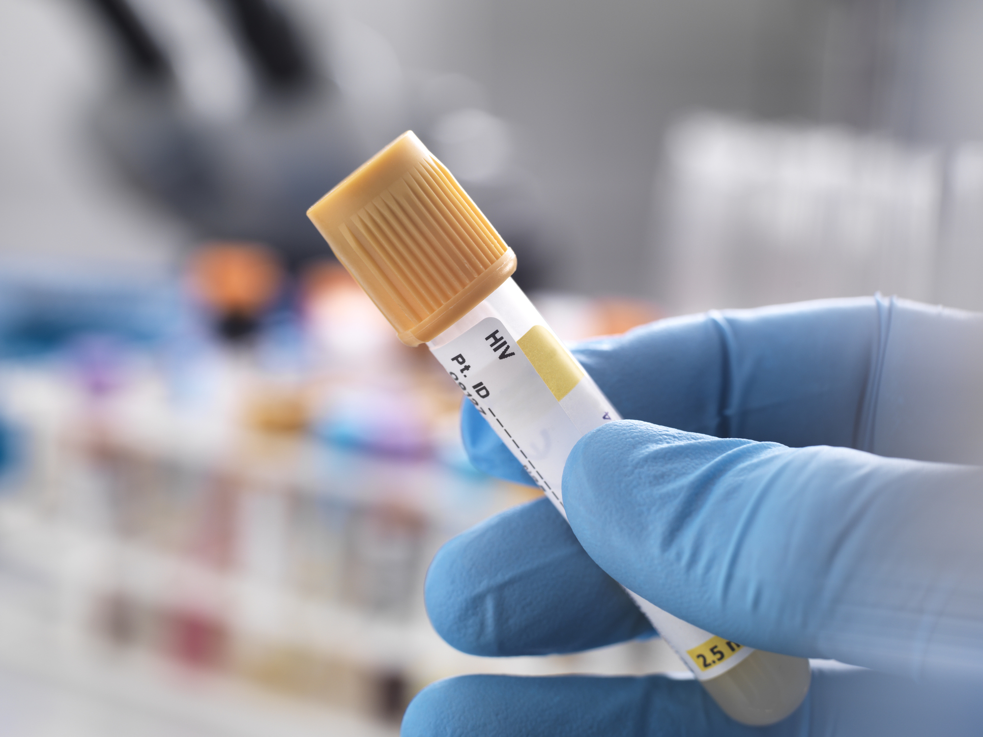 HIV cure