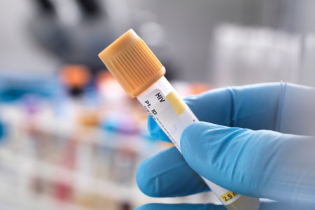 HIV cure