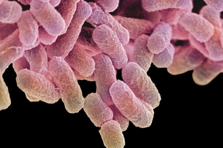 72 People Across Multiple States Sick with E. Coli, Baffling CDC