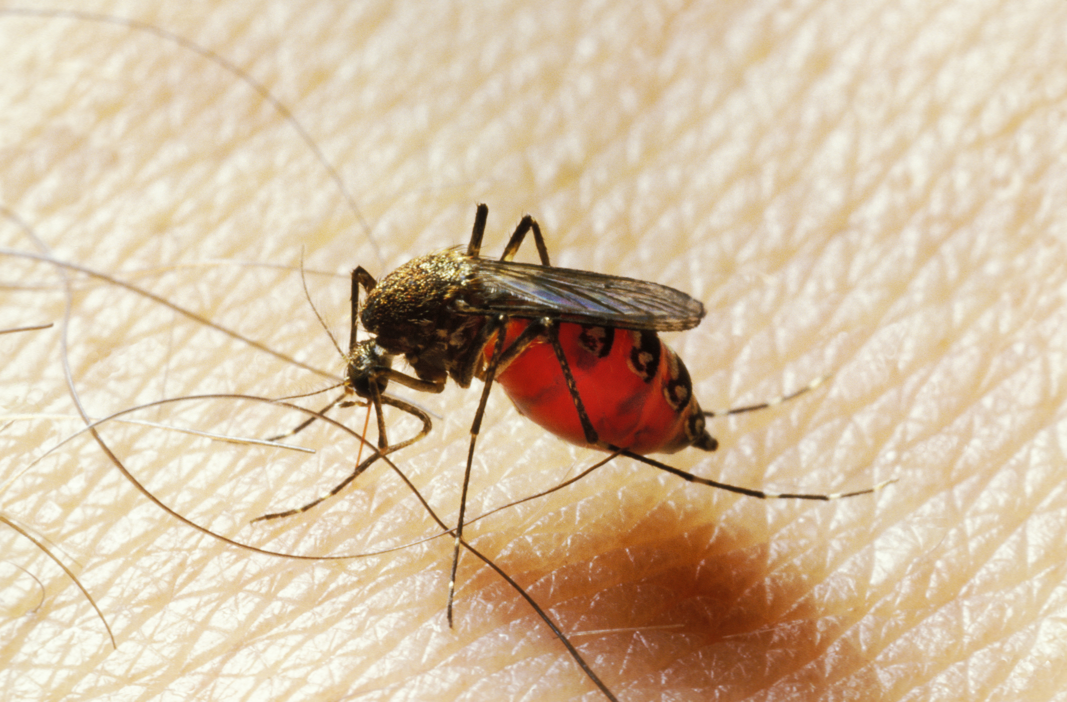 Mosquito bites