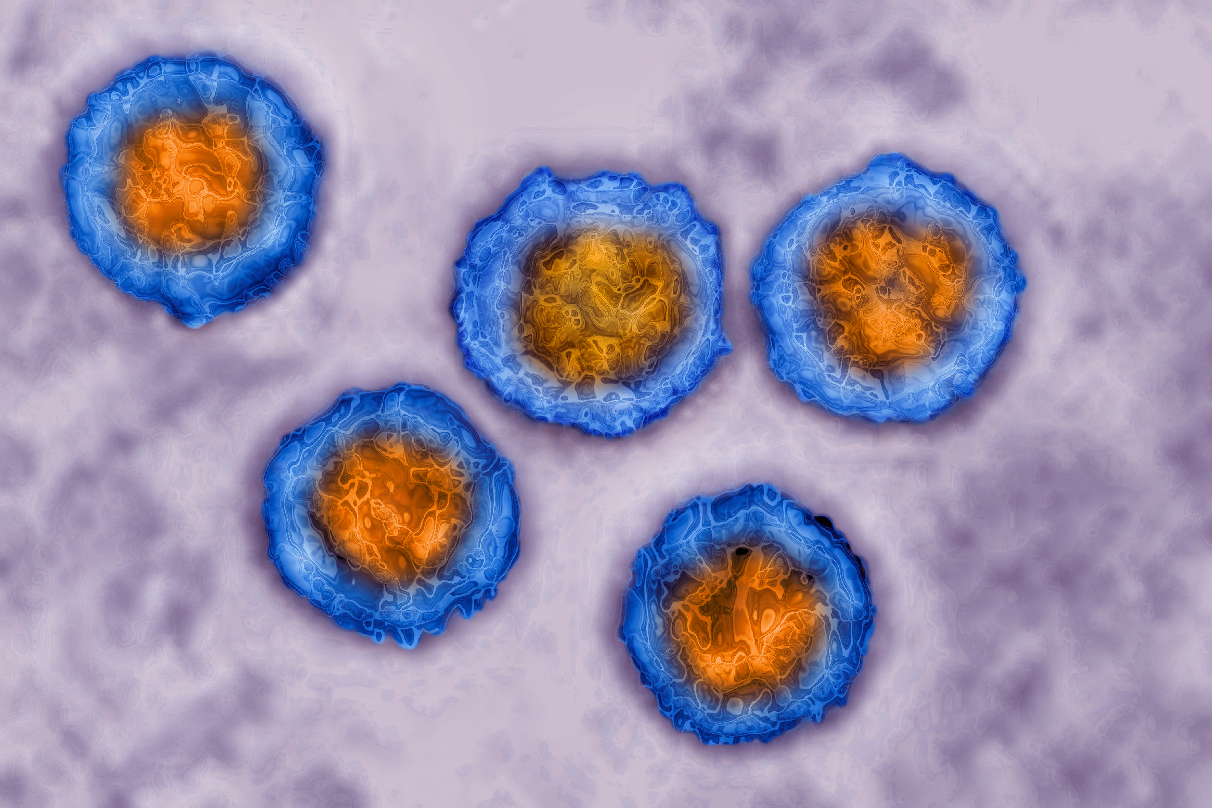 herpes
