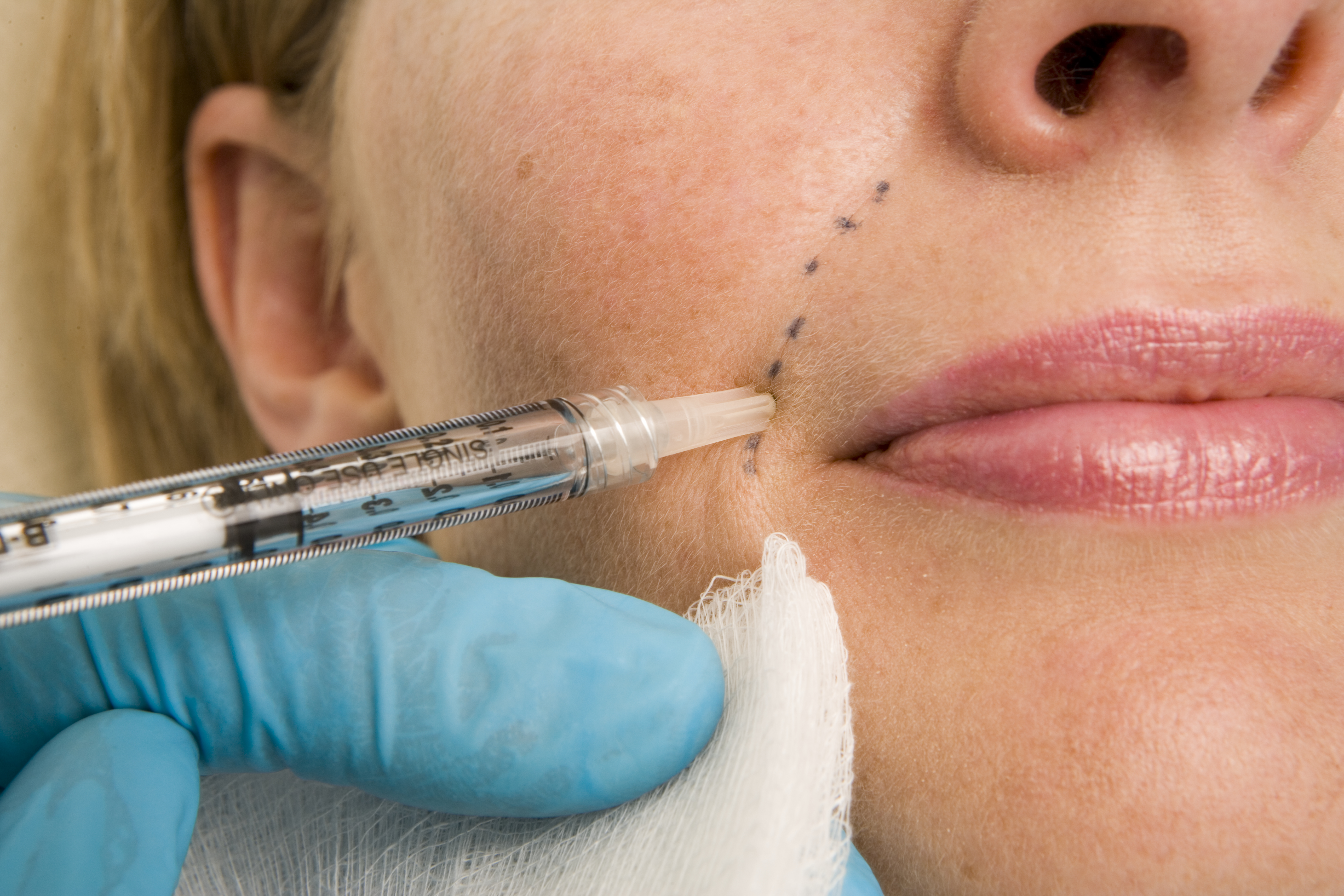 plastic surgery in lockdown