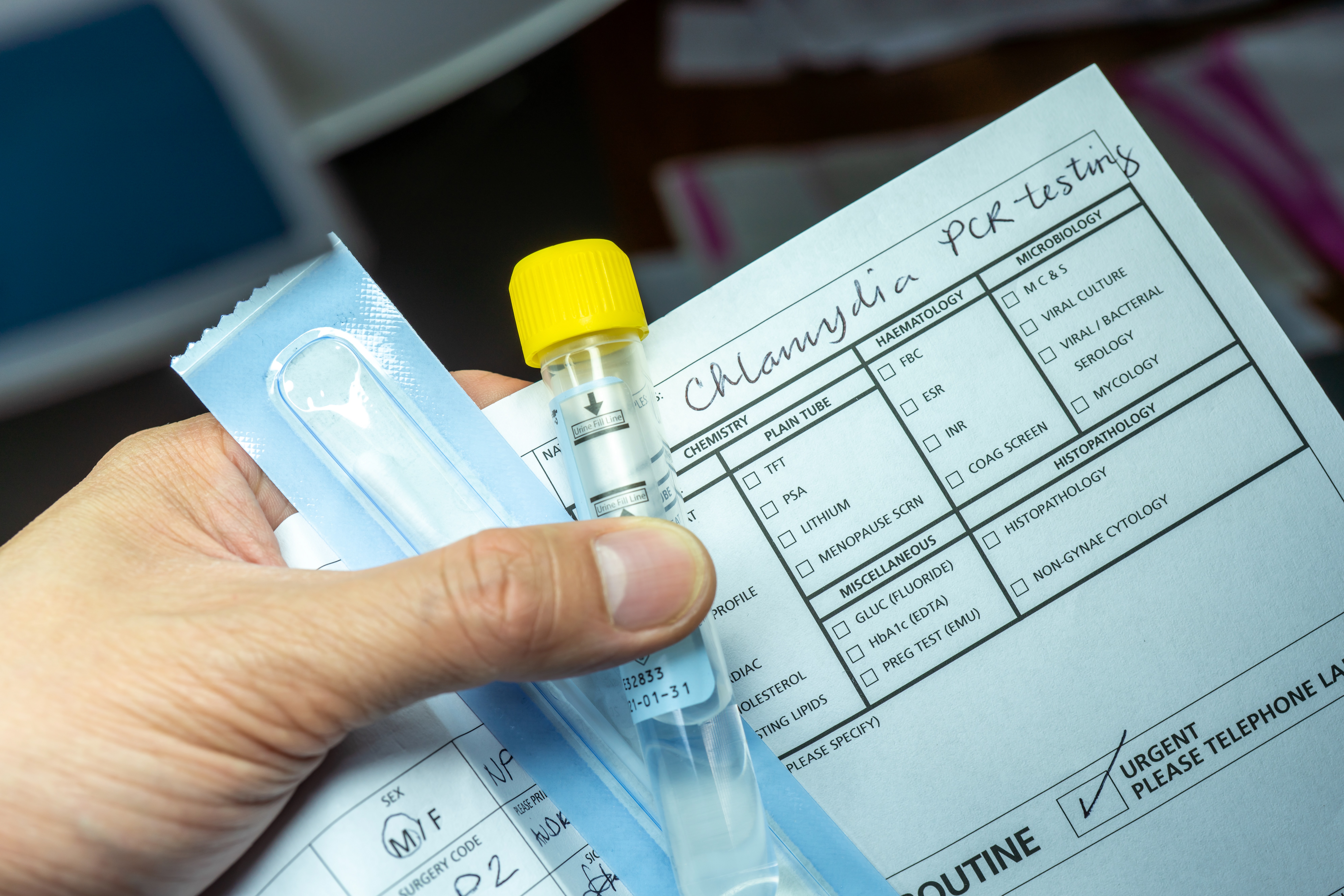 STI test