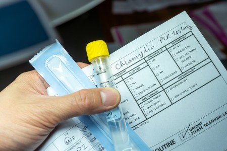 STI test