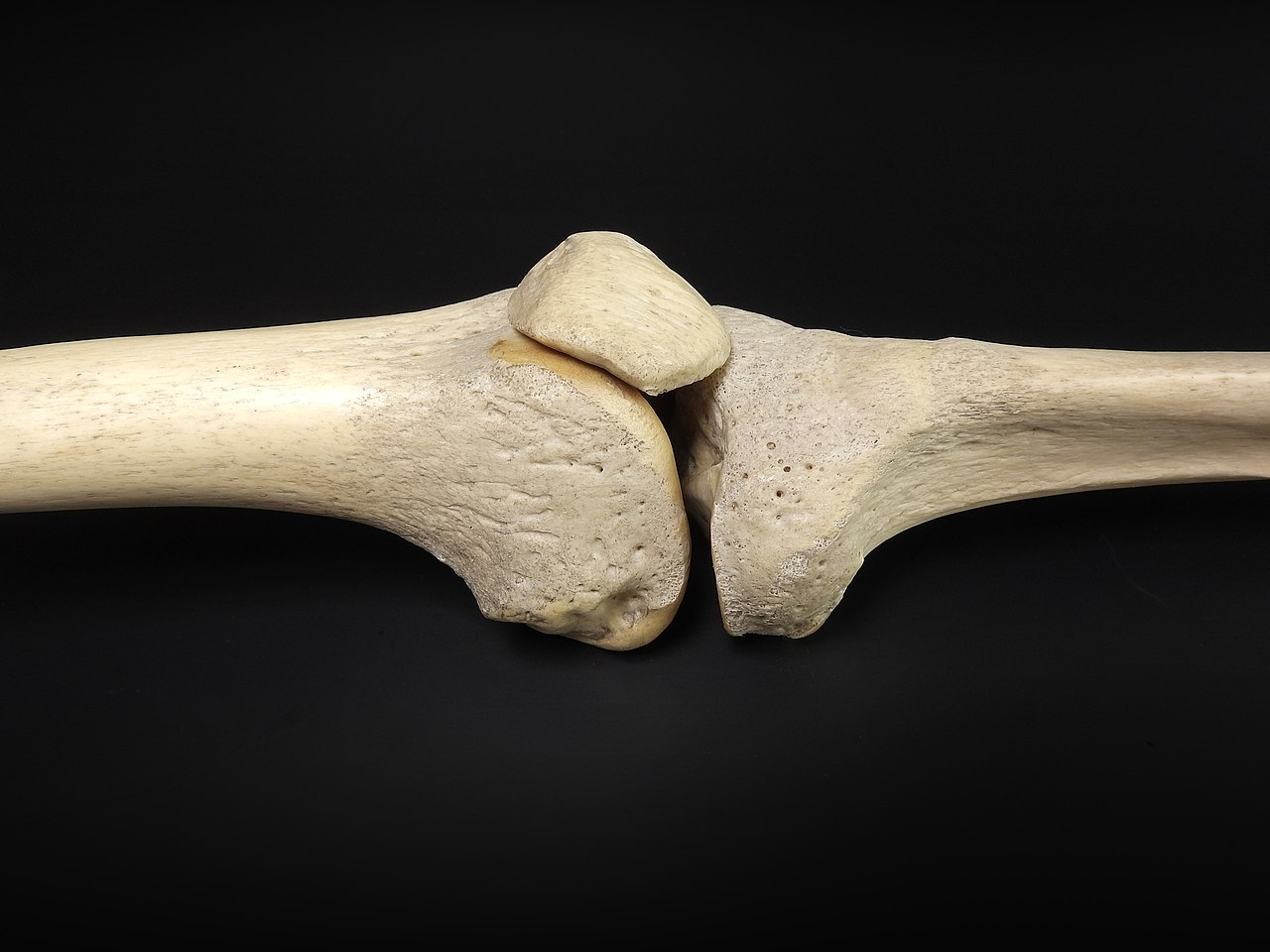 Knee bones