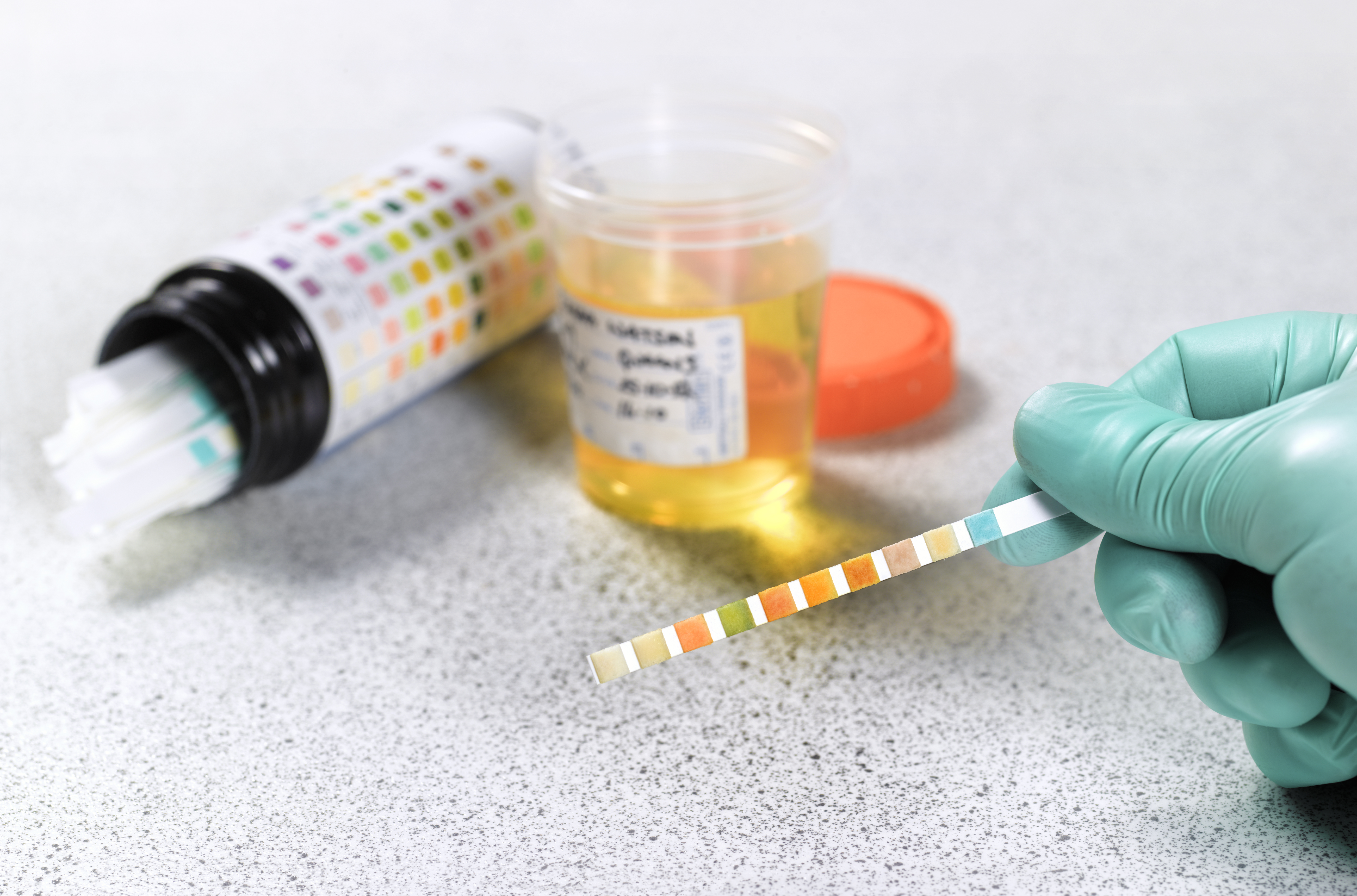 drug tests