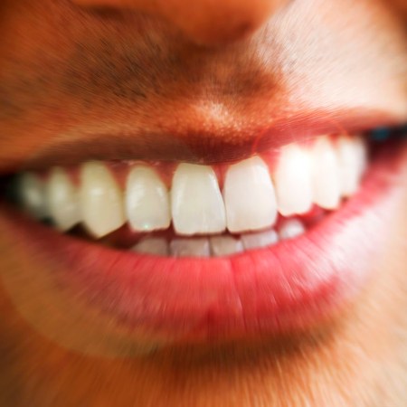 Do Any At-Home Teeth-Whitening Products Actually Work? A Dentist Weighs In.