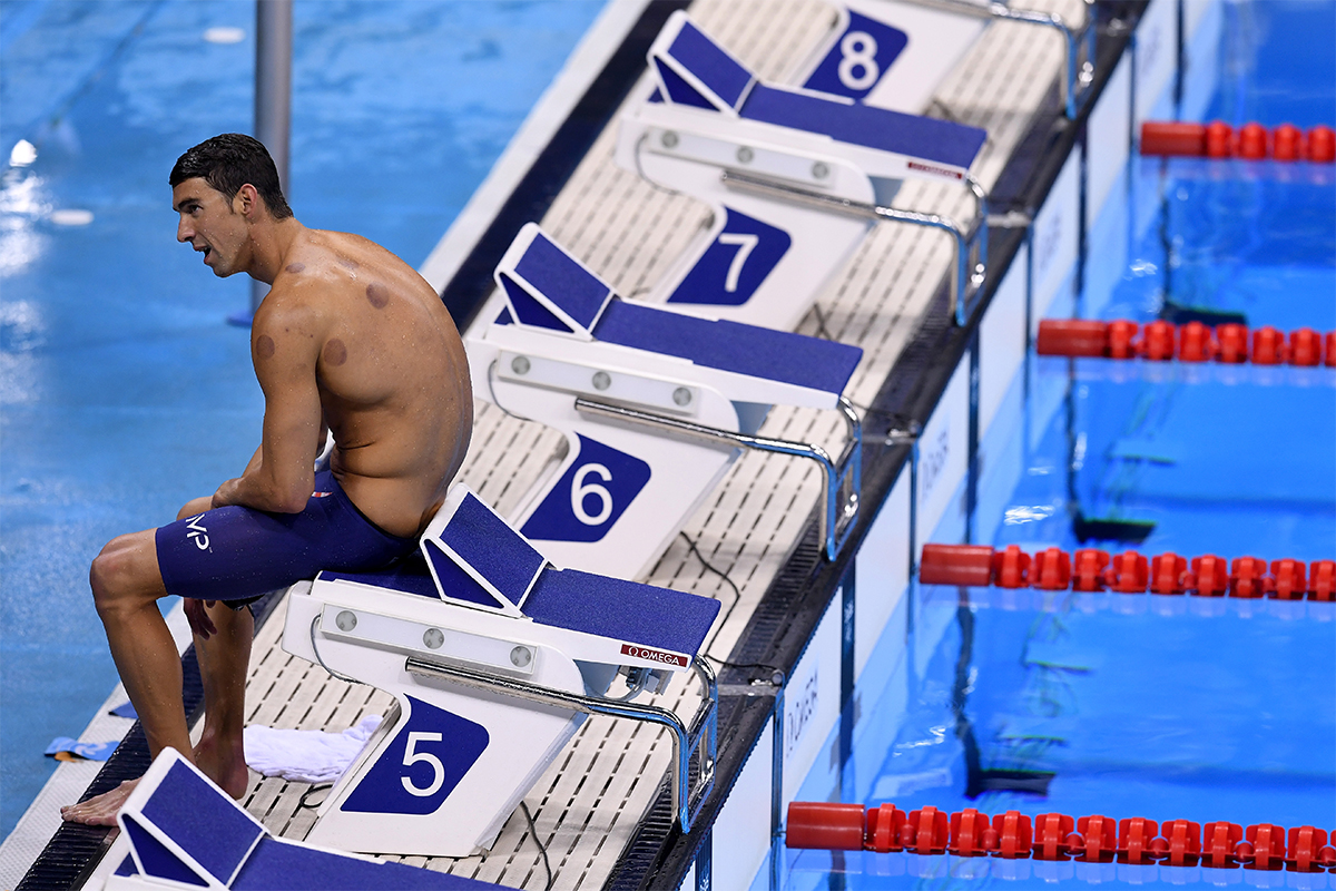 cupping therapy phelps