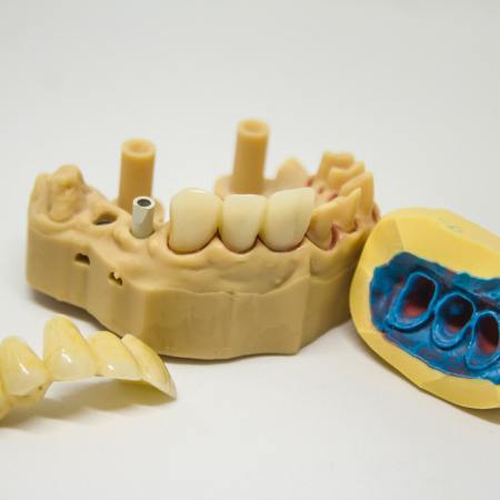 Dental models