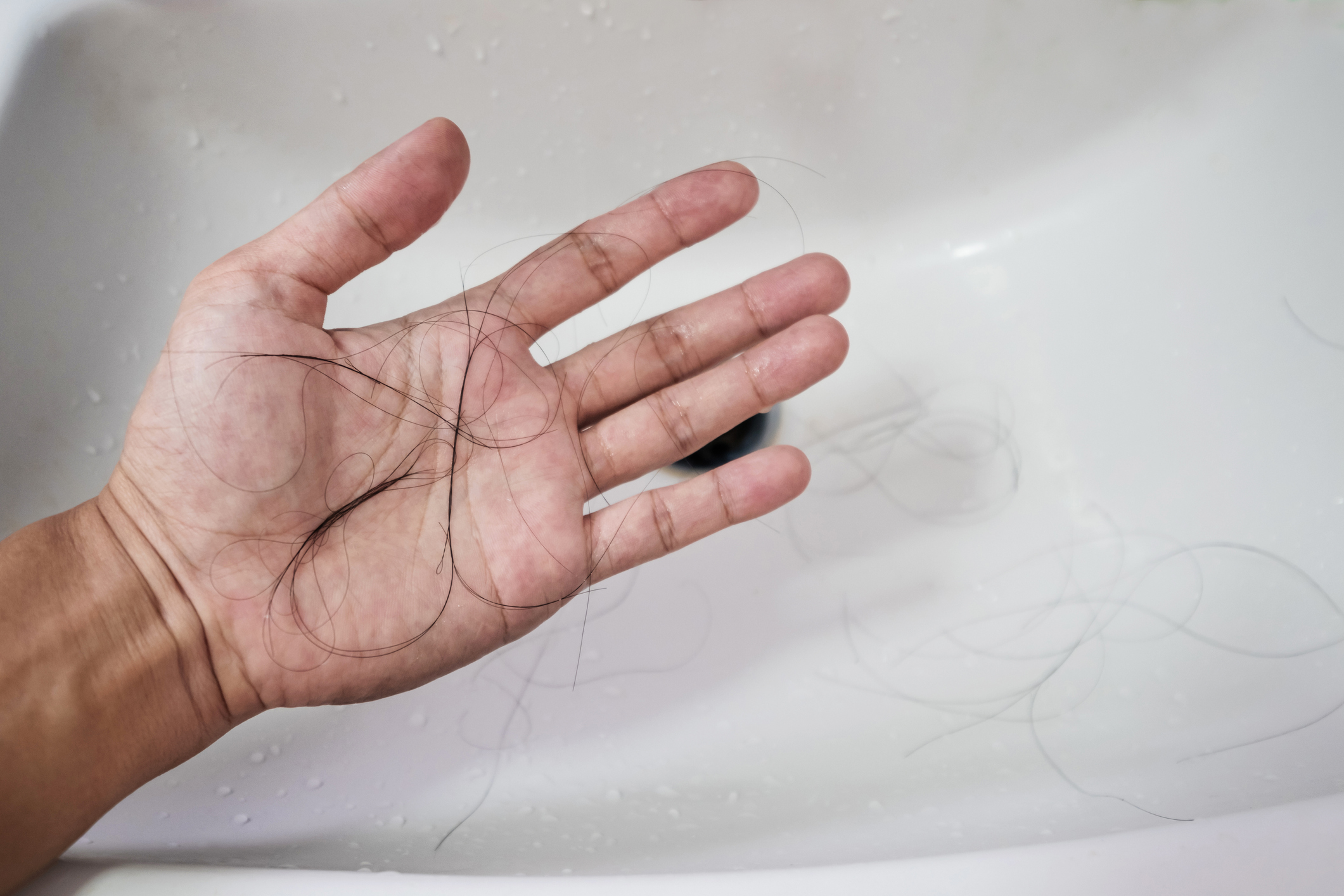 Hair loss
