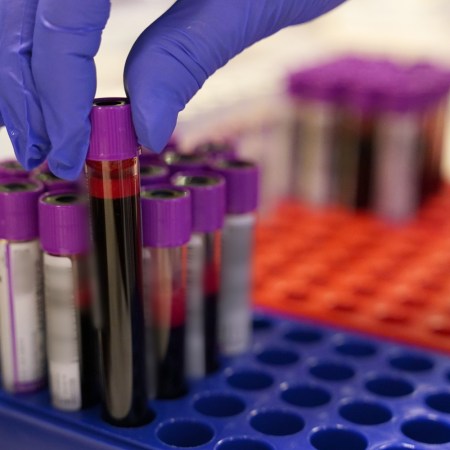 Blood in test tubes