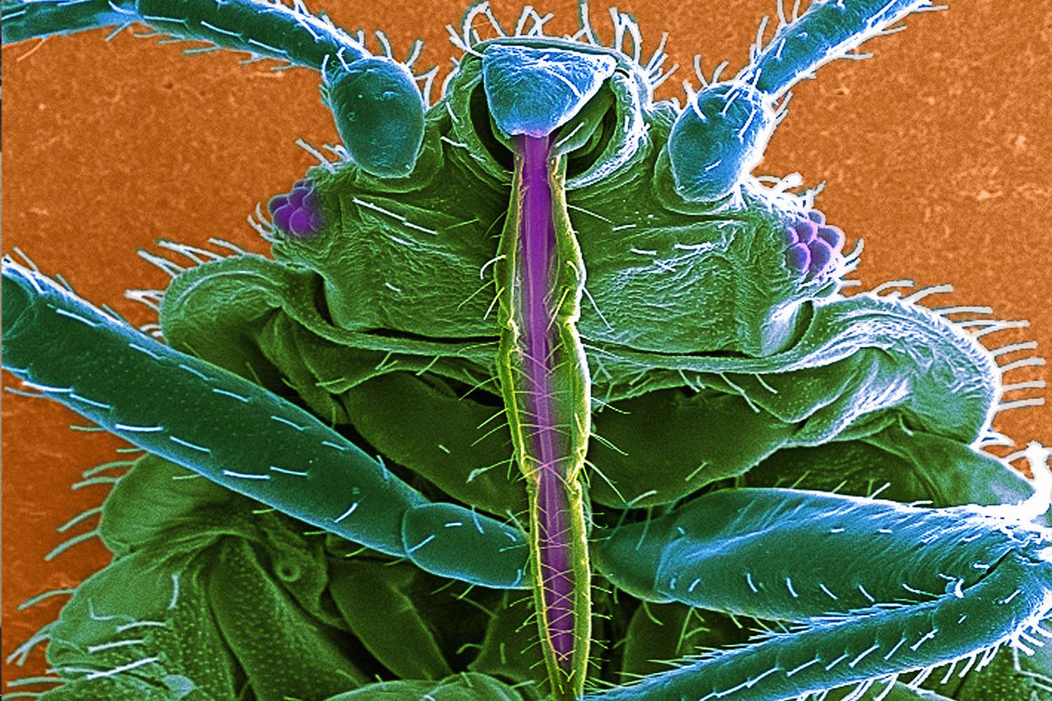 SEM of bedbug