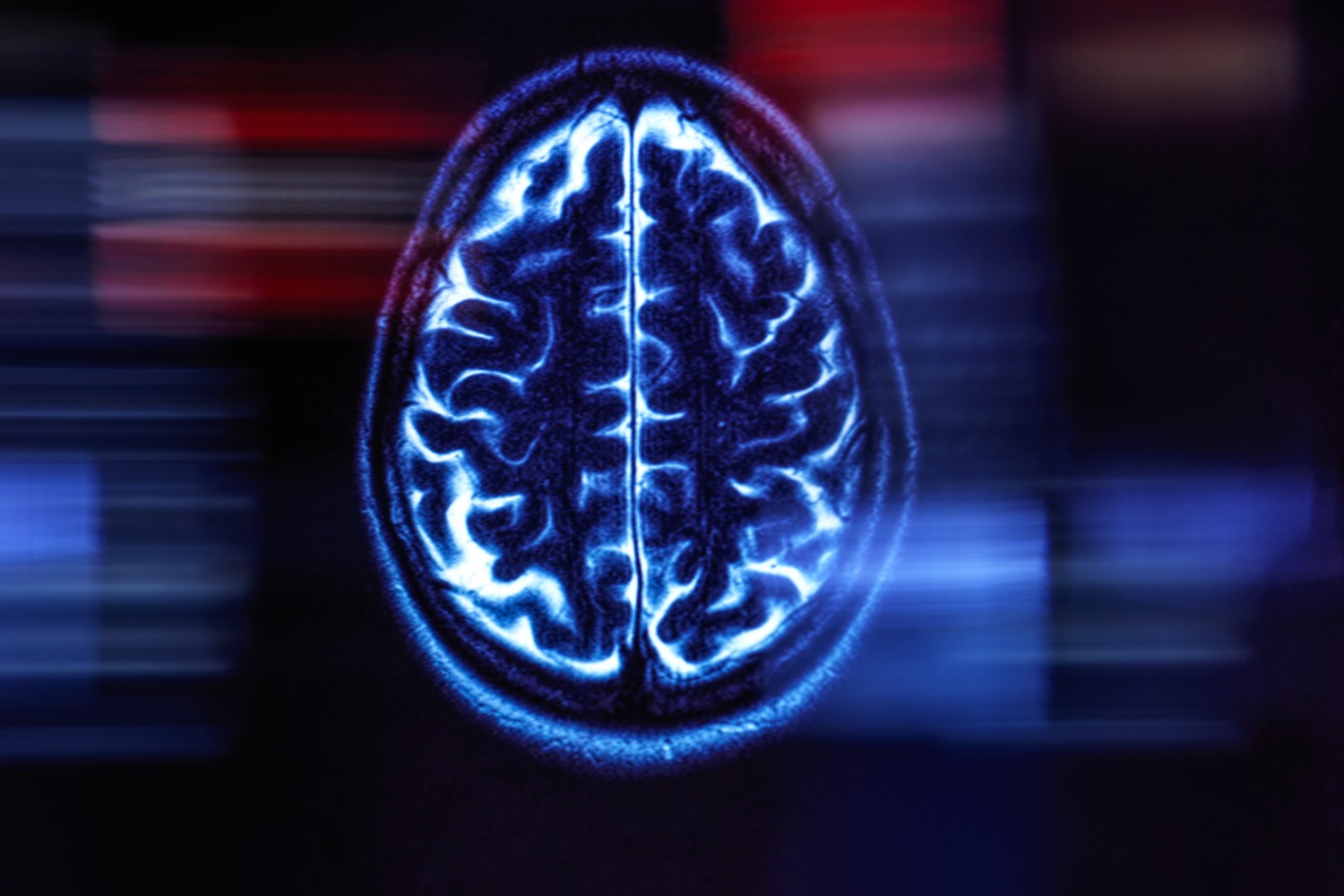 Brain scan