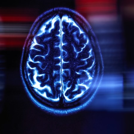 Brain scan