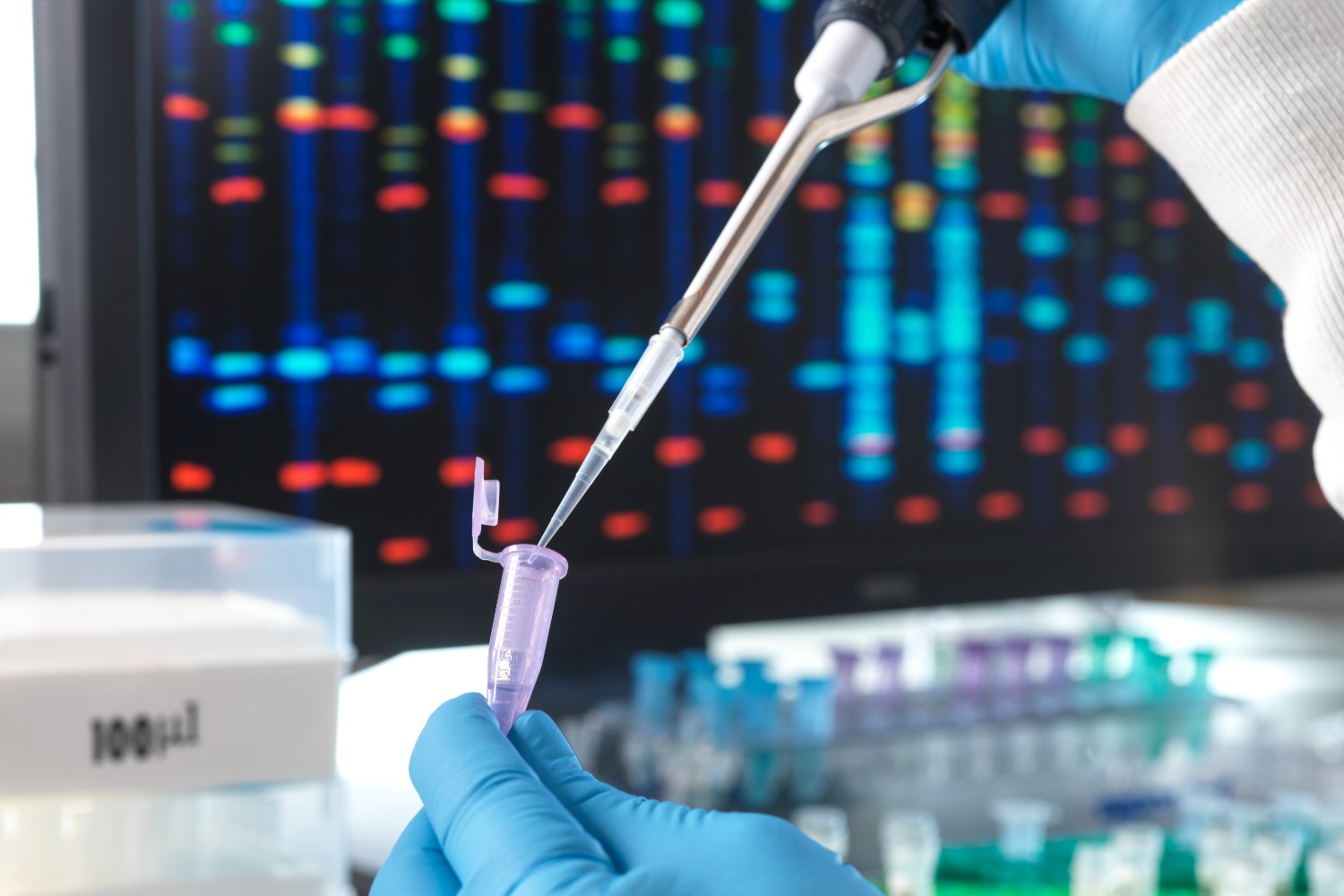 DNA testing