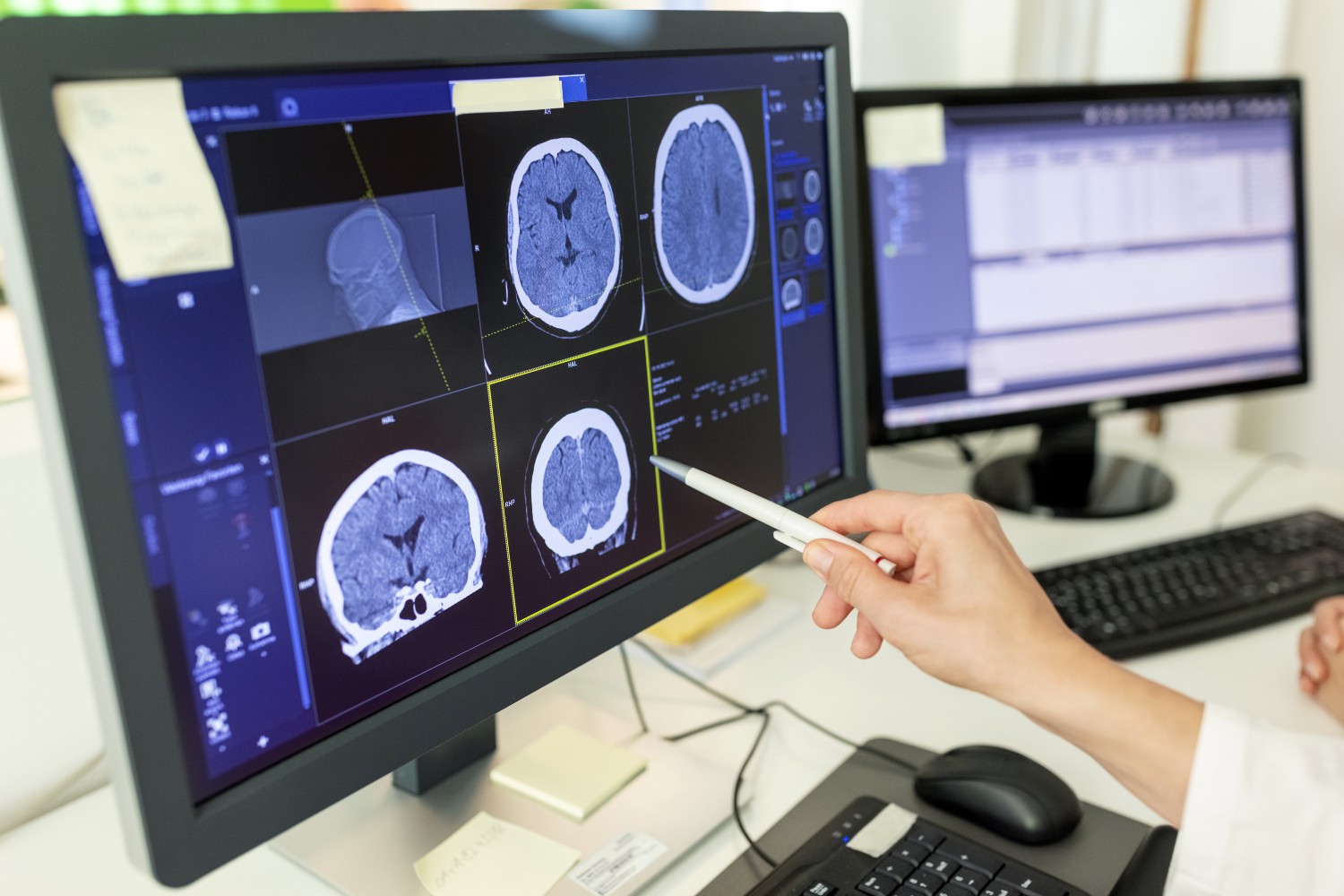 Brain scan