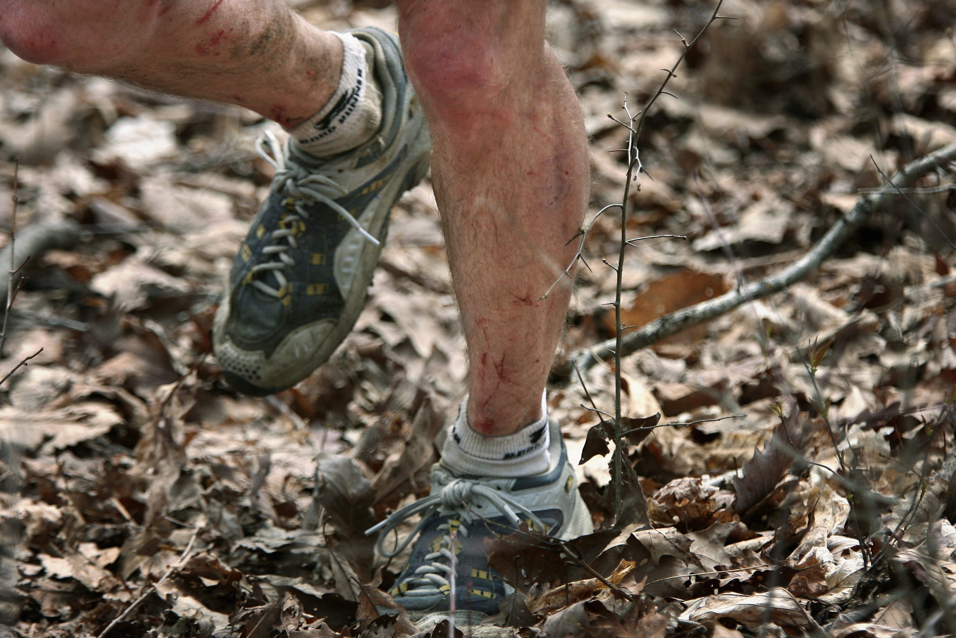 The legs of someone who attempted the Barkley Marathons.