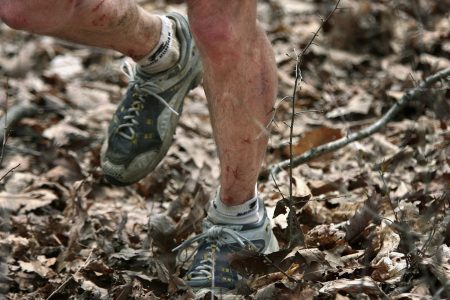 The legs of someone who attempted the Barkley Marathons.