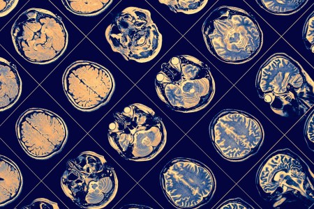 Nauseous Mice Can Help Scientists  Understand the Human Brain