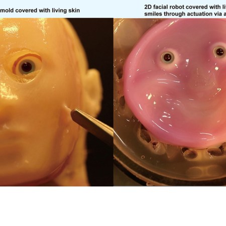Skin robot