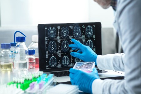 Can One Protein Make a Difference in Preventing Alzheimer’s Disease?
