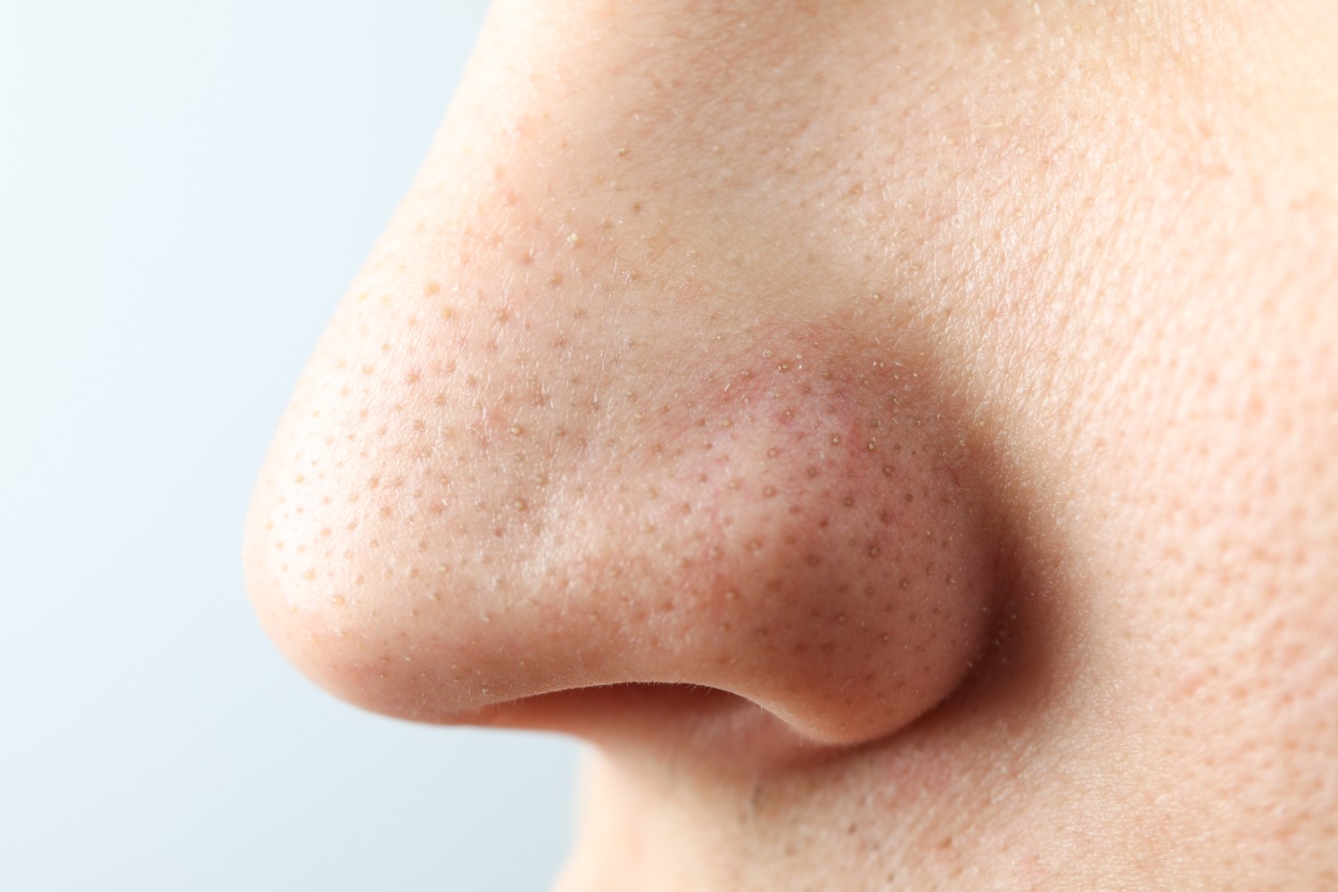 A nose