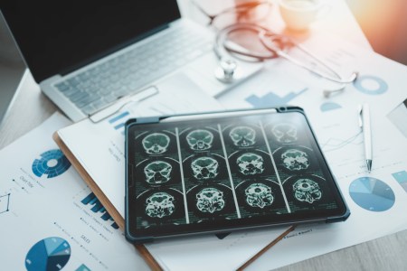 Study Explores How Infections Can Increase Your Risk of Dementia