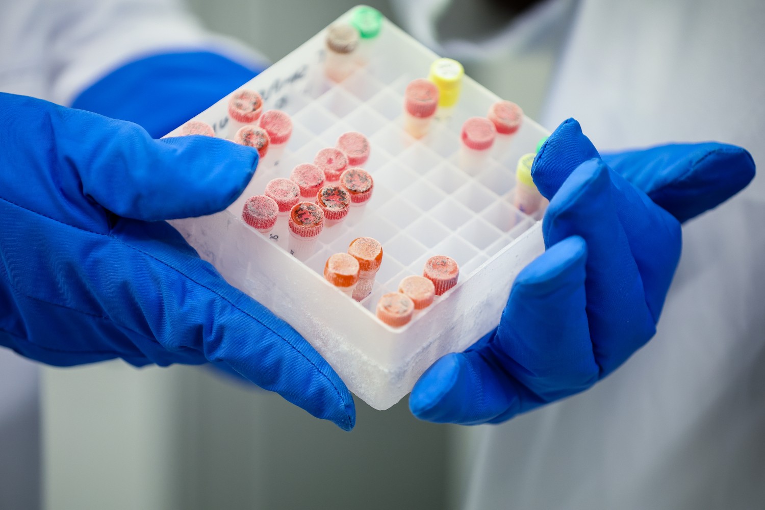 Fat cells in a lab
