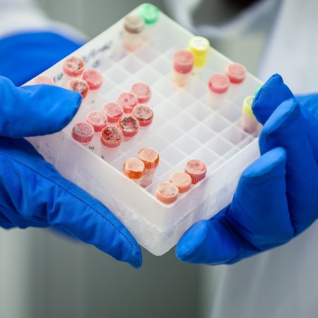 Fat cells in a lab