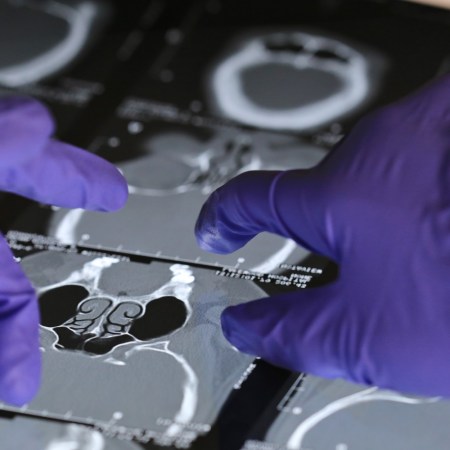 Doctor looking at an x-ray